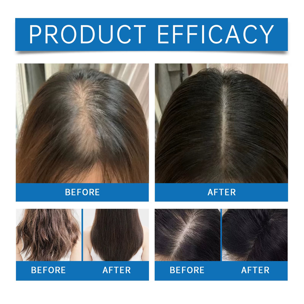 Rosemary Hair Serum